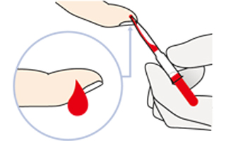 アレルギー検査 指先採血